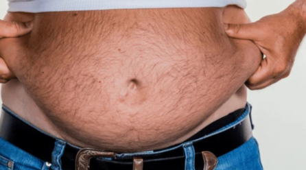Apron Belly: Causes and Healthy Management Strategies