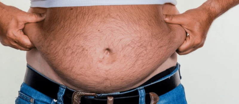 Apron Belly: Causes and Healthy Management Strategies