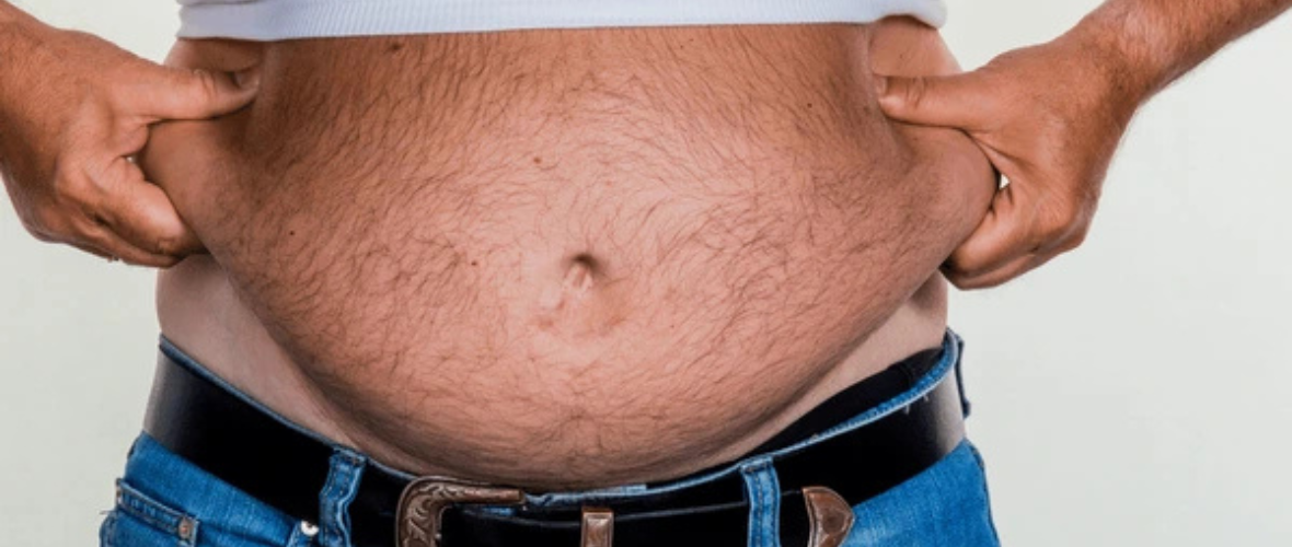 Apron Belly: Causes and Healthy Management Strategies