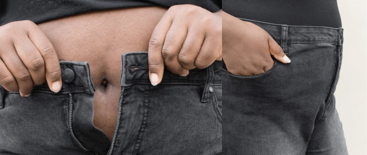 FUPA Explained: Definition, Causes, and Care Options