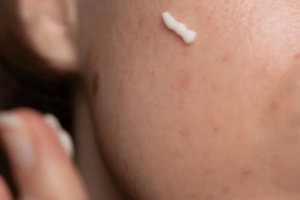 Do Retinoids Help Reduce Wrinkles? Evidence and Effectiveness