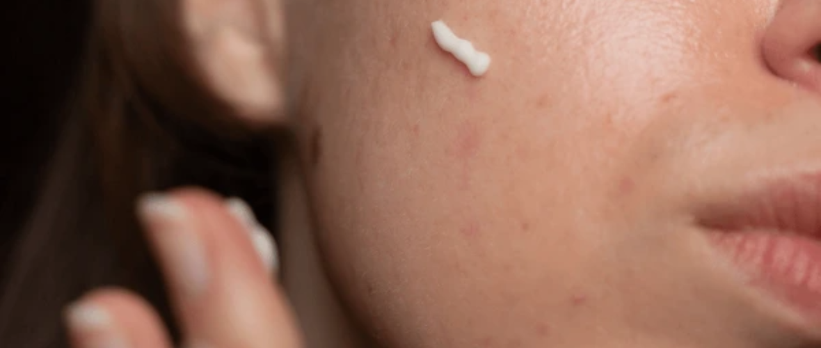 Do Retinoids Help Reduce Wrinkles? Evidence and Effectiveness