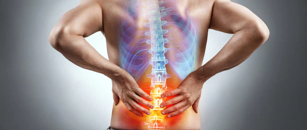 Retrolisthesis: Diagnosis, Management, and Prevention