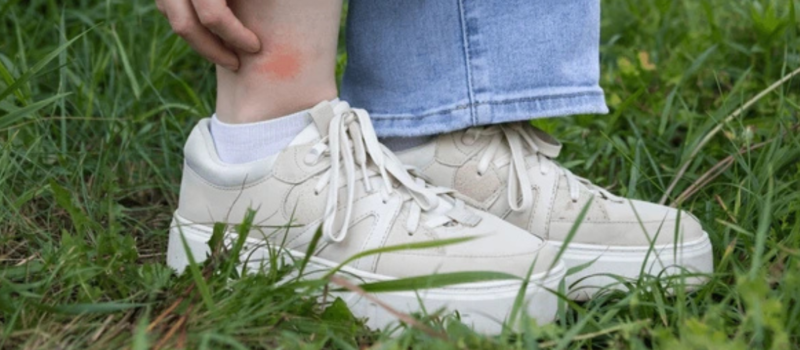 Healthy Body Line—Understand and Treat Cankles Naturally