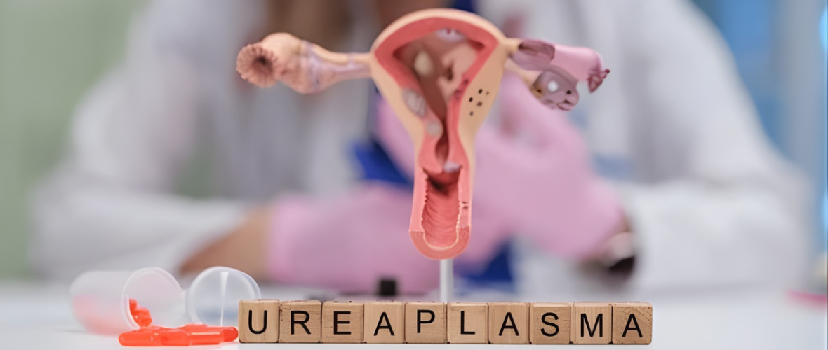 Ureaplasma Explained: Causes, Symptoms & Treatment Options
