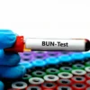 Blood Urea Nitrogen (BUN) test blood sample tube for kidney function analysis