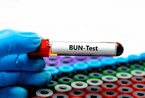 Blood Urea Nitrogen (BUN) test blood sample tube for kidney function analysis
