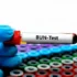 Blood Urea Nitrogen (BUN) test blood sample tube for kidney function analysis